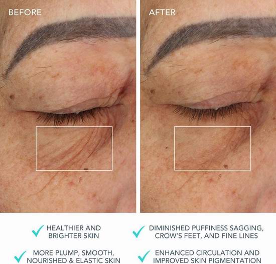 白菜价!历史新低!FOREO BEAR 智能微电流美容仪3.5折 149.7加元包邮!无创即时提拉!