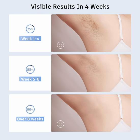 历史新低!Finequin IPL 激光永久脱毛仪5.6折 89.99加元包邮!