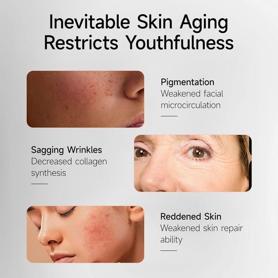 历史新低!URMARK 专业7合1抗衰老 红光光疗面膜仪5折 99.99加元包邮!