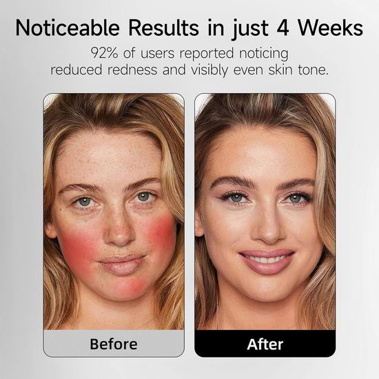 历史新低!URMARK 专业7合1抗衰老 红光光疗面膜仪5折 99.99加元包邮!