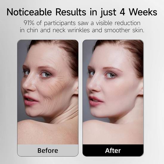 历史新低!URMARK 专业7合1抗衰老 红光光疗面膜仪5折 99.99加元包邮!